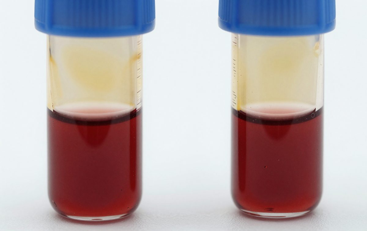 Two blue-capped tubes after centrifugation: clear plasma on top, blood cells below
